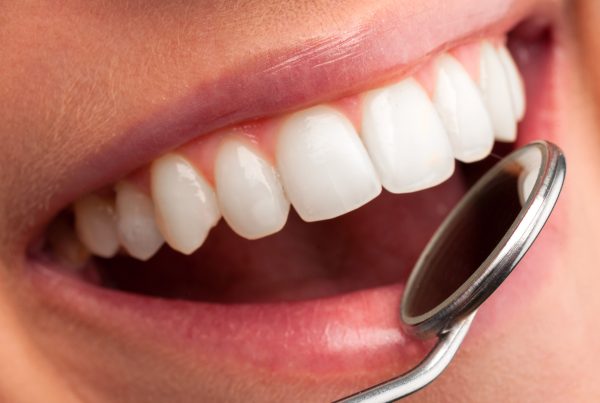 fluoro per i denti
