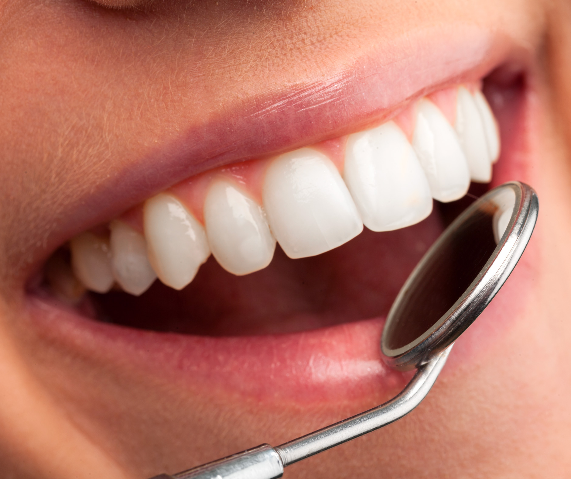 Il fluoro: alleato o nemico dei denti?