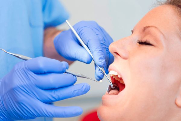 otturazione dentale