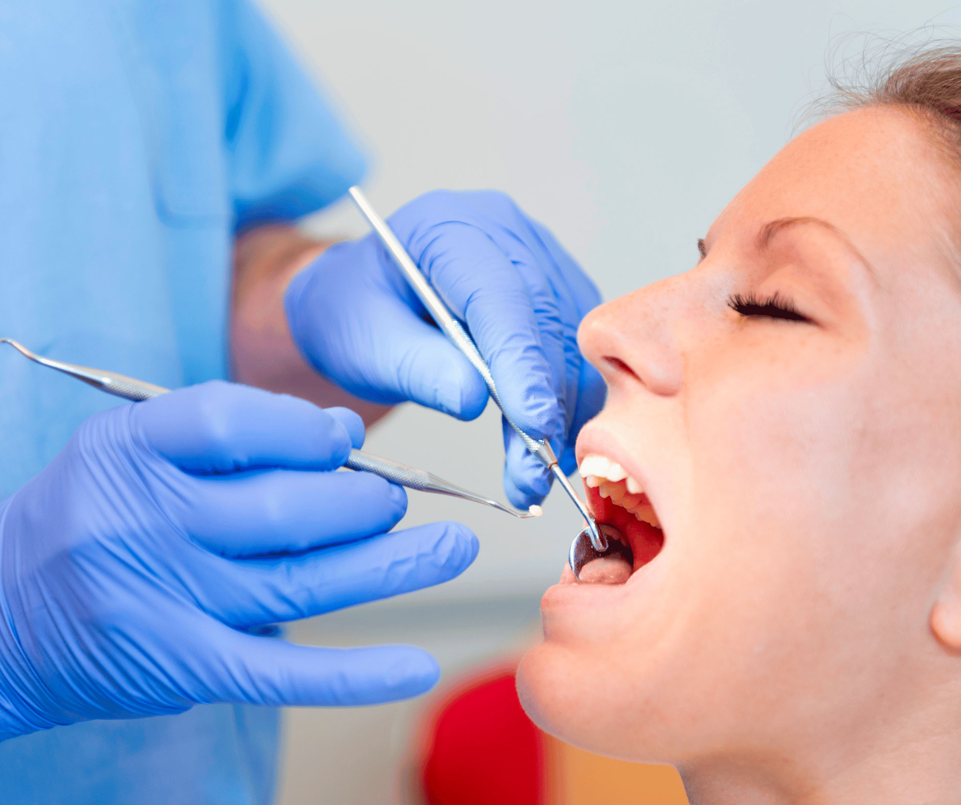 Otturazione dentale: trattamento per restaurare i denti danneggiati