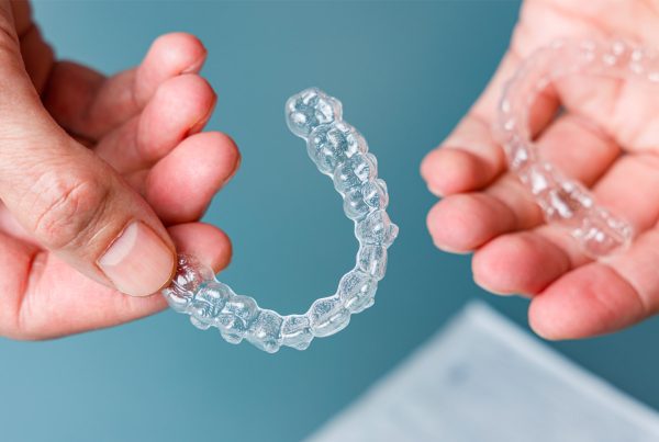 invisalign