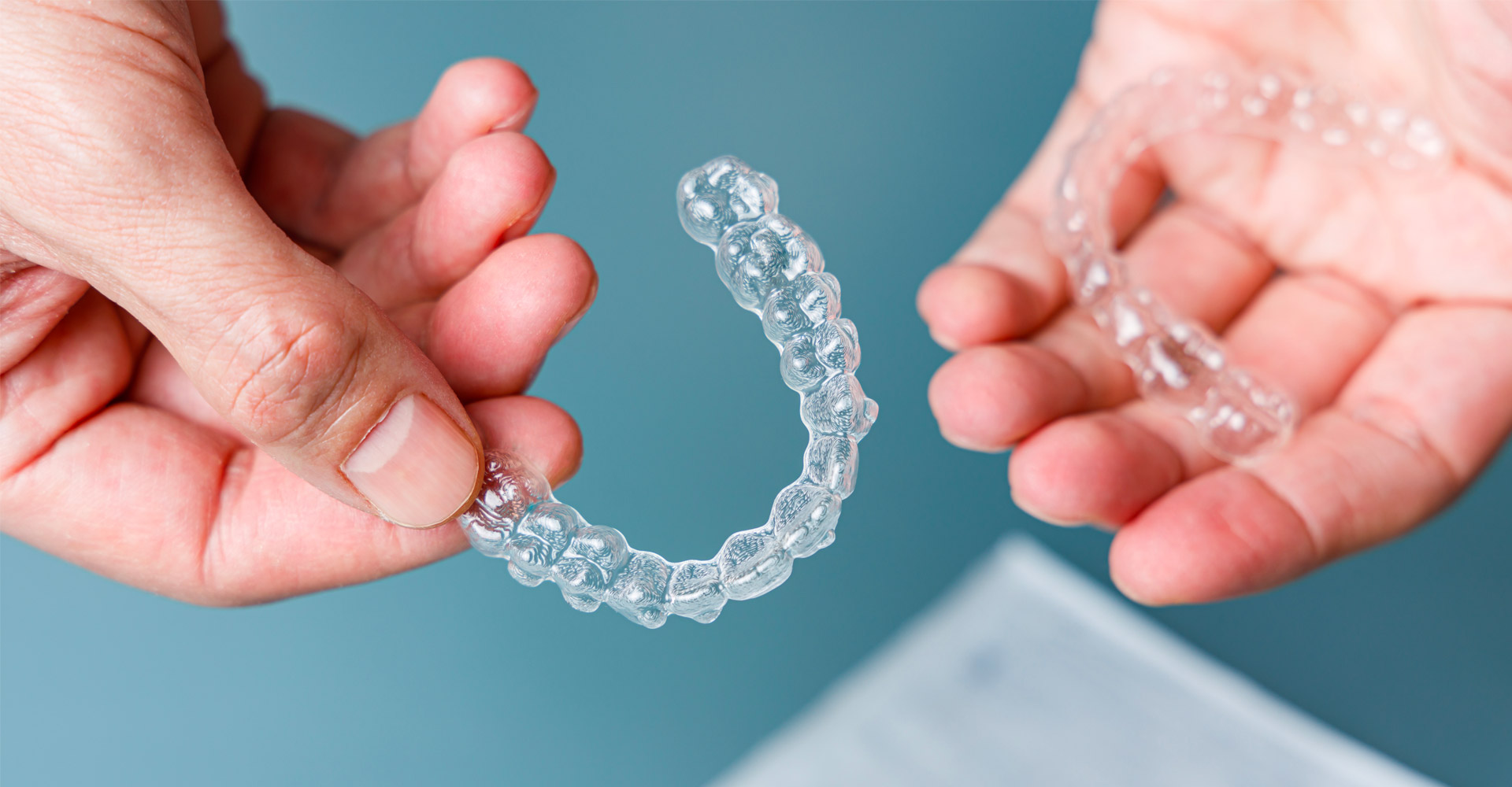 Come correggere l’allineamento dentale: Invisalign