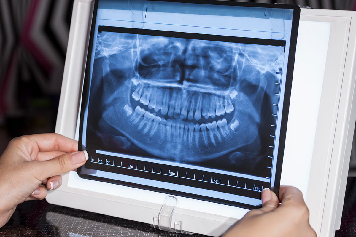 L’Evoluzione della Diagnostica: la Radiografia Digitale